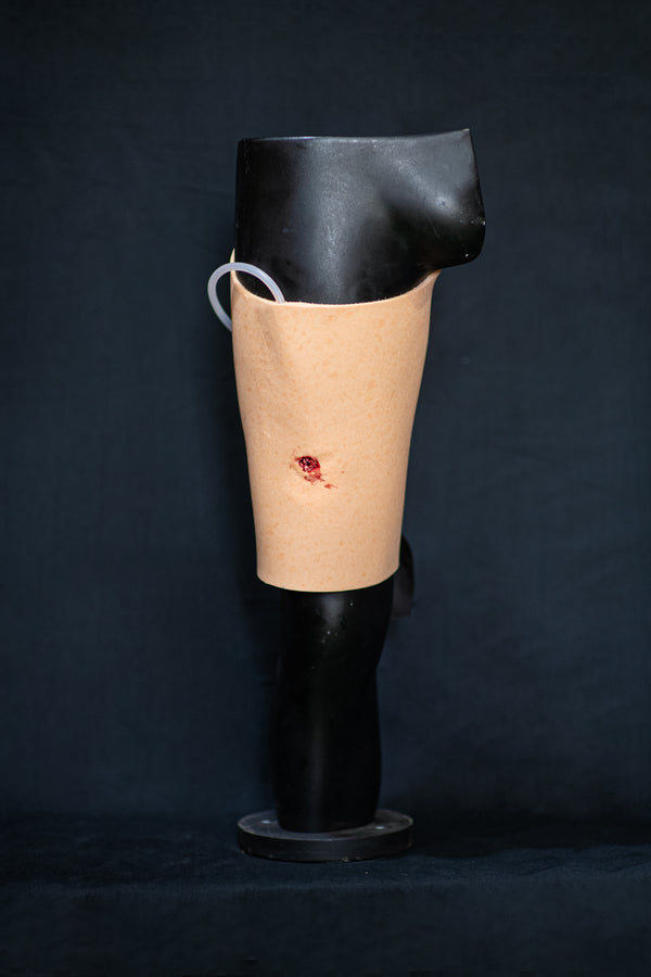 Bullet and Shrapnel Wounds