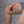 Severe Wounds